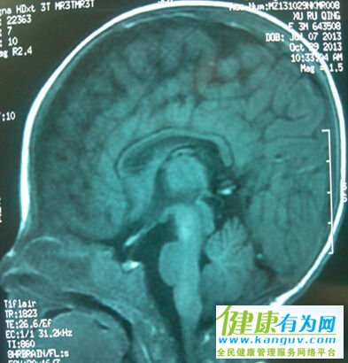 ˵MRI 