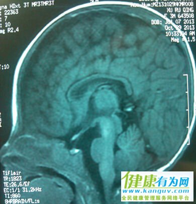  MRI,