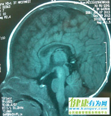  MRI,
