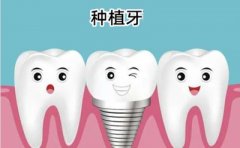 种植牙何时才能纳入医保?四川地区种植牙哪家医院做得好?